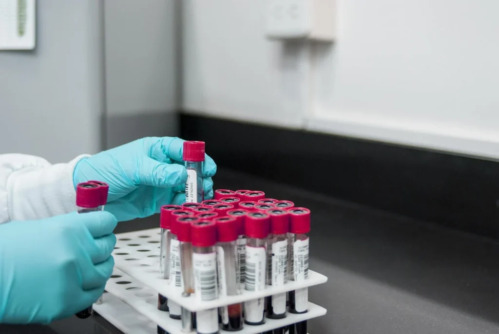 Adult reviewing cholesterol lab results at a kitchen table
